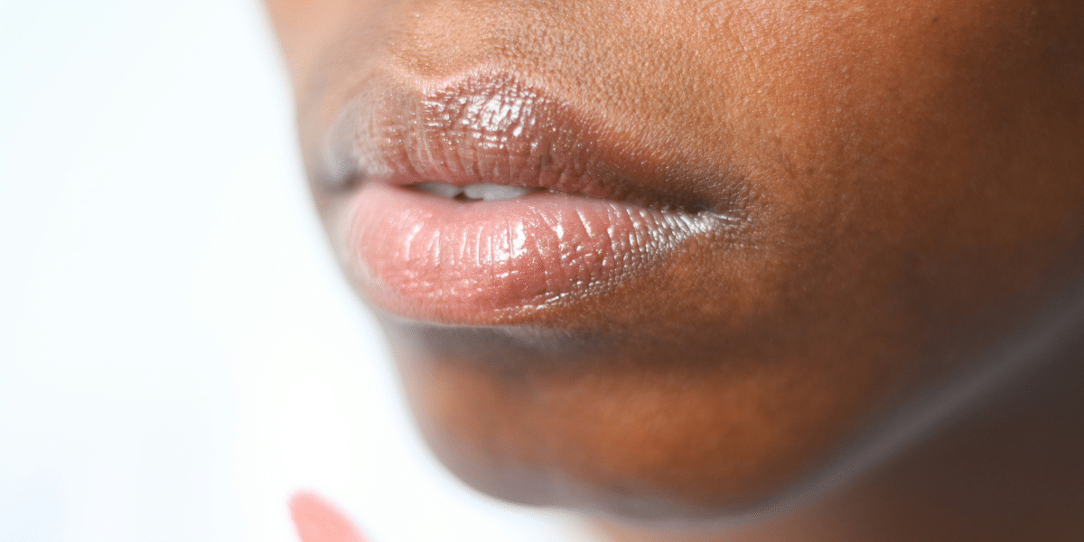 Lip Lift: Permanent Solutions for Lip Enhancement