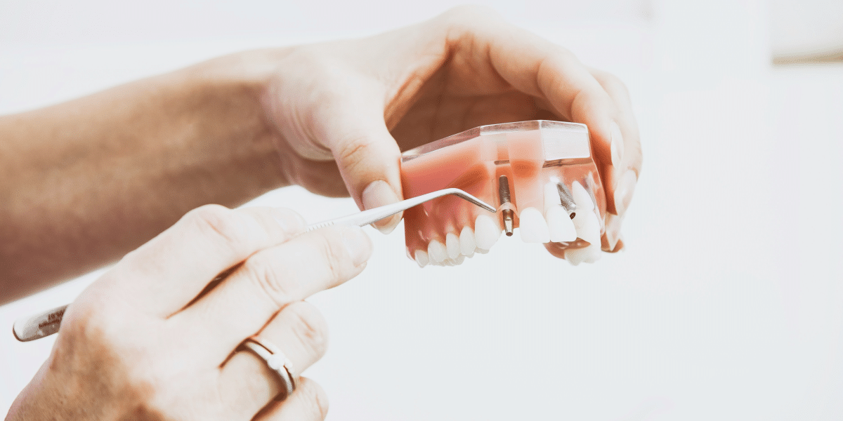 Proactive Dental Health: Expert Tips for Denture Maintenance