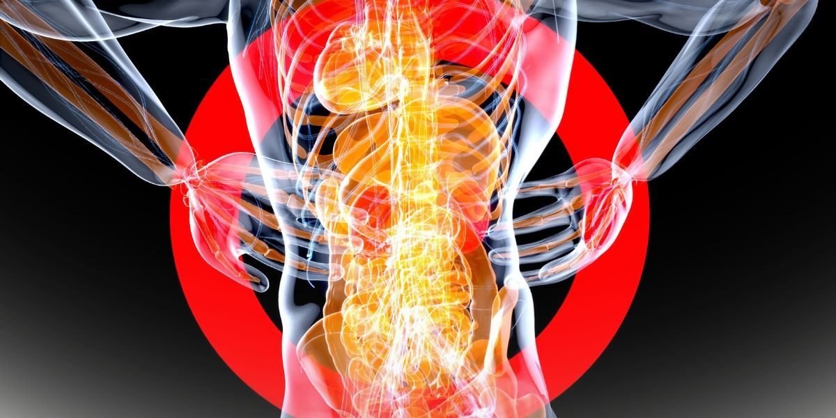 A New Florida MRI Study of Spinal Decompression Is Making the Rounds. Here Is How Ocoee Readers Can Size It Up